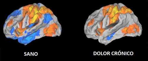 Neuroplasticidad sistema nervioso